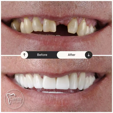 Slider image (2) DentaPoint International Dental Hospital